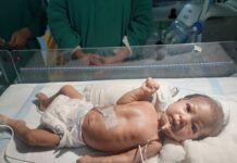 विवेकानंद अस्पताल में डेढ़ माह की बच्ची की जटिल सर्जरी, मिला नया जीवन